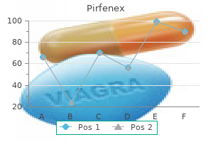 order cheapest pirfenex