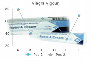 generic 800 mg viagra vigour free shipping