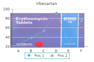 irbesartan 300 mg fast delivery