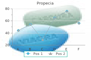 cheap propecia 5mg amex