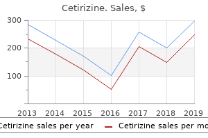cetirizine 10mg amex