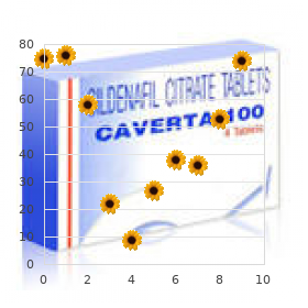 Takayasu arteritis