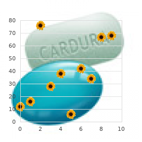 Bidirectional tachycardia