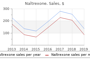 order 50mg naltrexone free shipping