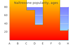 buy naltrexone 50mg on-line