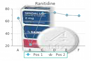 cheapest generic ranitidine uk