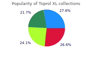 cheap toprol xl 100mg without prescription