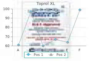 order 100mg toprol xl with visa