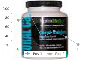 order actos line
