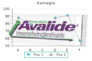 buy kamagra 50mg free shipping